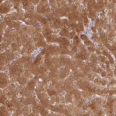 Immunohistochemistry-Paraffin: ALDH8A1 Antibody [NBP2-38753]