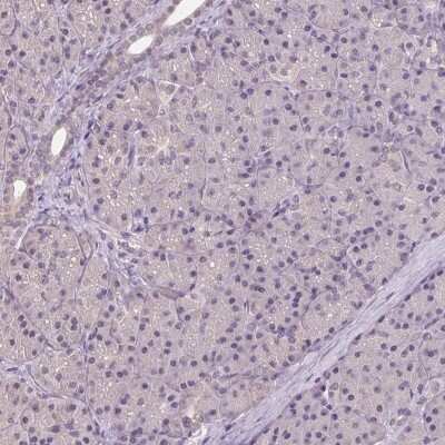 Immunohistochemistry-Paraffin: ALDH8A1 Antibody [NBP2-38753]