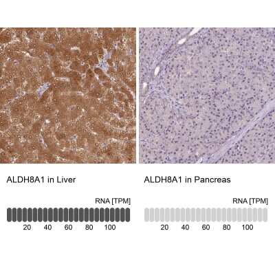 Immunohistochemistry-Paraffin: ALDH8A1 Antibody [NBP2-38753]