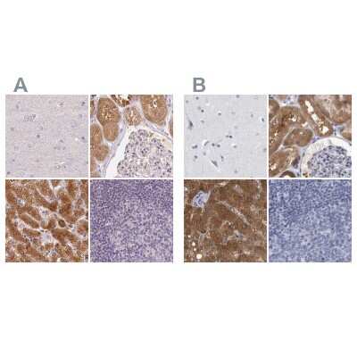 Immunohistochemistry-Paraffin: ALDH8A1 Antibody [NBP2-38753]
