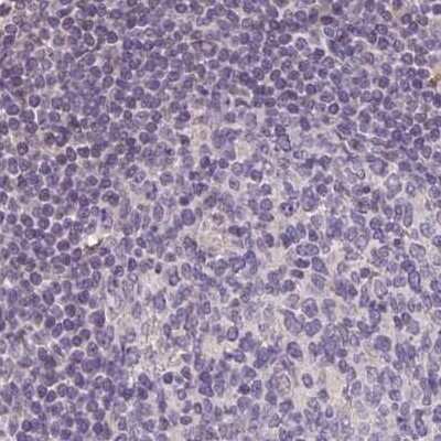 Immunohistochemistry-Paraffin: ALDH8A1 Antibody [NBP2-38753]