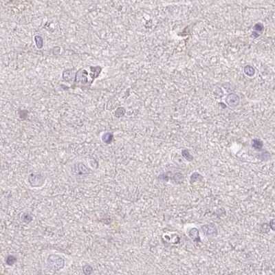 Immunohistochemistry-Paraffin: ALDH8A1 Antibody [NBP2-38753]