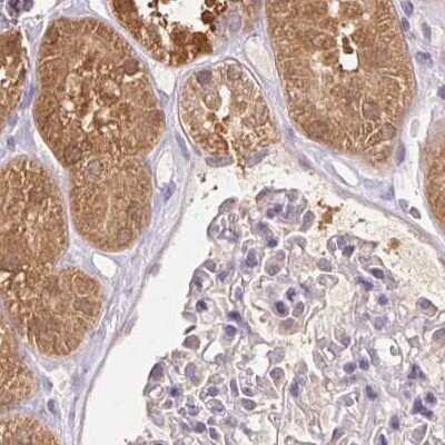 Immunohistochemistry-Paraffin: ALDH8A1 Antibody [NBP2-38753]