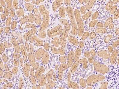 Immunohistochemistry-Paraffin: ALDH8A1 Antibody [NBP2-99392]