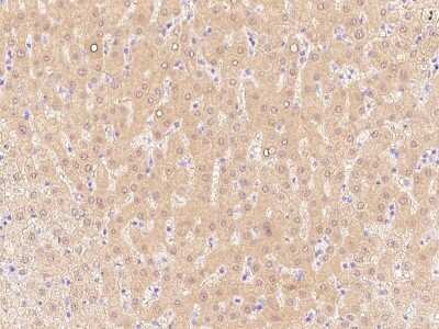 Immunohistochemistry-Paraffin: ALDH8A1 Antibody [NBP2-99392]