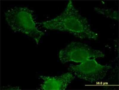 Immunocytochemistry/ Immunofluorescence: ALDH9A1 Antibody (3C6) [H00000223-M01]