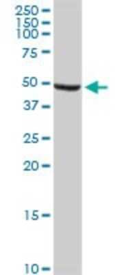 Western Blot: ALDH9A1 Antibody (3C6) [H00000223-M01]