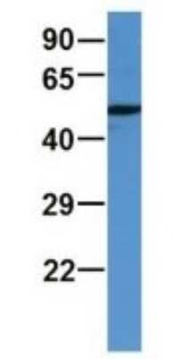 Western Blot: ALDH9A1 Antibody [NBP1-69138]