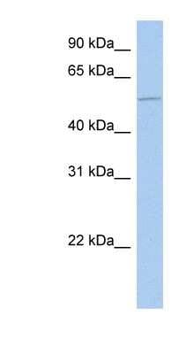 Western Blot: ALG1 Antibody [NBP1-62497]