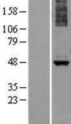 Western Blot: ALG1 Overexpression Lysate [NBL1-07463]