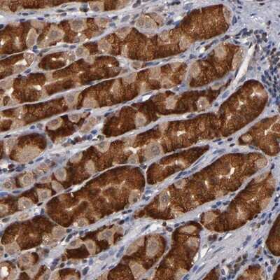Immunohistochemistry-Paraffin: ALG13 Antibody [NBP1-84330]