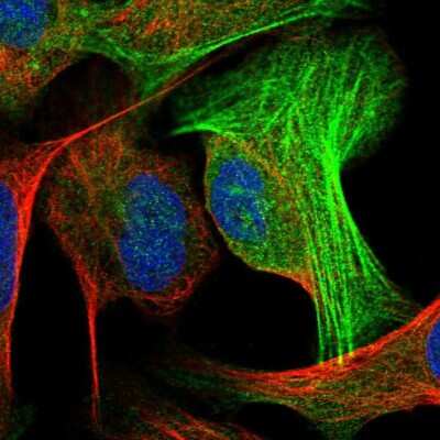 Immunocytochemistry/ Immunofluorescence: ALG2 Antibody [NBP1-85715]