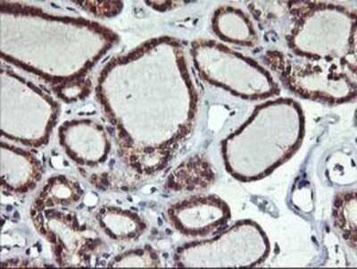 Immunohistochemistry: ALG2 Antibody (OTI3C2) - Azide and BSA Free [NBP2-72308]