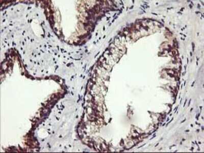 Immunohistochemistry: ALG2 Antibody (OTI3C2) - Azide and BSA Free [NBP2-72308]