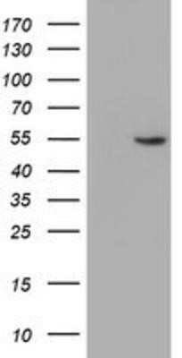 Western Blot: ALG2 Antibody (OTI3C2) [NBP2-01734]
