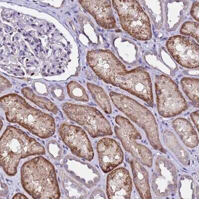 Immunohistochemistry-Paraffin: ALG3 Antibody [NBP1-91658]