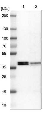 Western Blot: ALG5 Antibody [NBP1-88767]