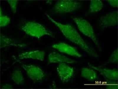 Immunocytochemistry/ Immunofluorescence: ALG6 Antibody (2G11) [H00029929-M09]