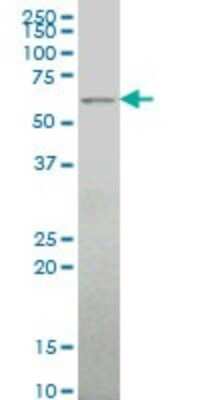 Western Blot: ALG6 Antibody (2G11) [H00029929-M09]
