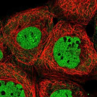 Immunocytochemistry/ Immunofluorescence: ALG8 Antibody [NBP2-47550]