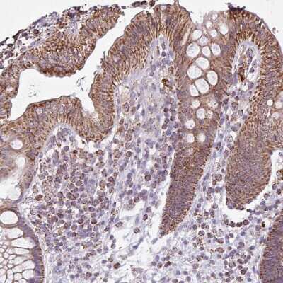 Immunohistochemistry-Paraffin: ALG8 Antibody [NBP2-47550]