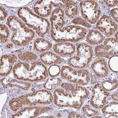 Immunohistochemistry-Paraffin: ALG8 Antibody [NBP2-47550]