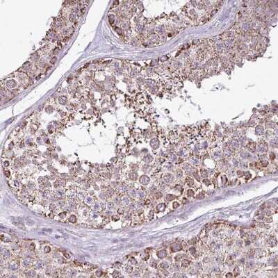 Immunohistochemistry-Paraffin: ALG8 Antibody [NBP2-47550]