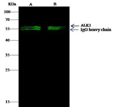 Immunoprecipitation: ALK-1 Antibody (124) [NBP2-89257]