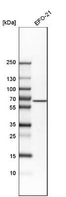 Western Blot: ALK-1 Antibody [NBP1-90254]