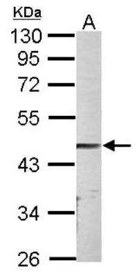 Western Blot: ALK-7/Activin Receptor Type 1C Antibody [NBP2-15272]