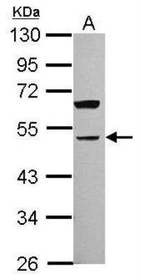 Western Blot: ALK-7/Activin Receptor Type 1C Antibody [NBP2-15272]