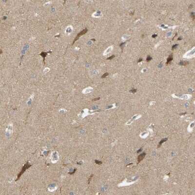 Immunohistochemistry-Paraffin: ALK/CD246 Antibody [NBP2-48518]