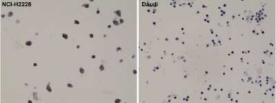 Immunohistochemistry: ALK/CD246 Antibody (RM361) [NBP2-77424]