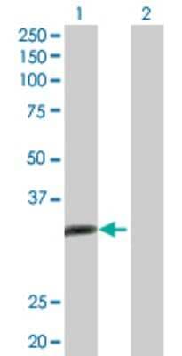 Western Blot: ALKBH3 Antibody [H00221120-D01P]