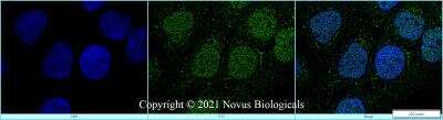 Immunocytochemistry/ Immunofluorescence: ALKBH5 Antibody - BSA Free [NBP2-78817]
