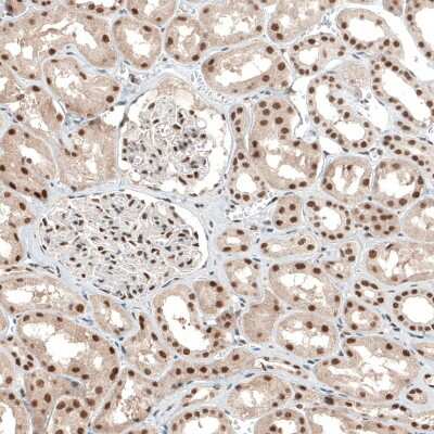 Immunohistochemistry-Paraffin: ALKBH5 Antibody [NBP1-82188]