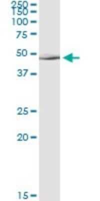 Immunoprecipitation: ALLC Antibody (3D3) [H00055821-M07]