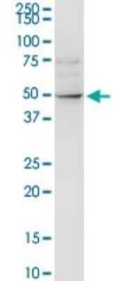 Western Blot: ALLC Antibody [H00055821-D01P]