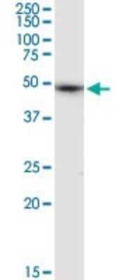 Western Blot: ALLC Antibody [H00055821-D01P]