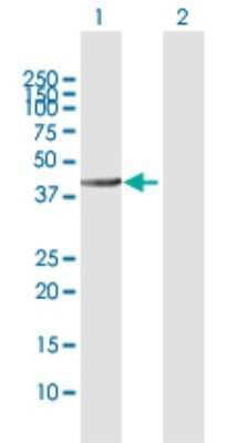 Western Blot: ALLC Antibody [H00055821-D01P]
