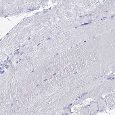 Immunohistochemistry-Paraffin: ALMS1 Antibody [NBP1-83015]