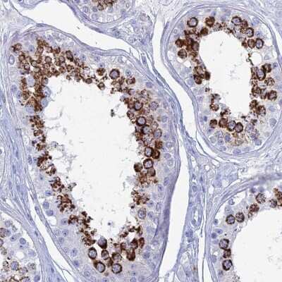 Immunohistochemistry-Paraffin: ALMS1 Antibody [NBP1-83015]