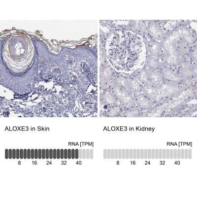 Immunohistochemistry-Paraffin: ALOXE3 Antibody [NBP2-62727]