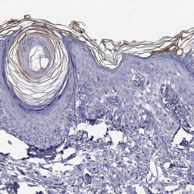 Immunohistochemistry-Paraffin: ALOXE3 Antibody [NBP2-62727]