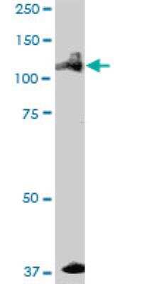 Western Blot: ALPK1 Antibody [H00080216-B01P]