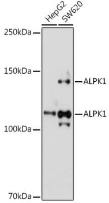 Western Blot: ALPK1 AntibodyAzide and BSA Free [NBP3-15997]