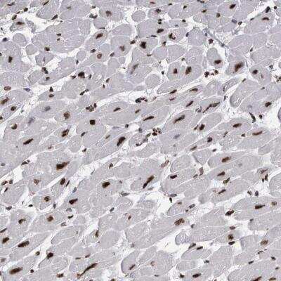 Immunohistochemistry-Paraffin: ALPK3 Antibody [NBP1-81417]
