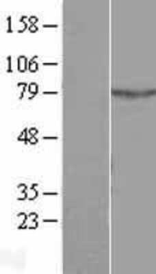 Western Blot: ALS2CR11 Overexpression Lysate [NBL1-07489]