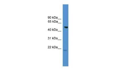 Western Blot: ALS2CR12 Antibody [NBP2-86983]