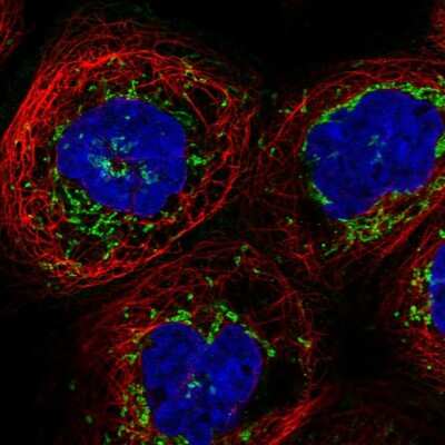 Immunocytochemistry/ Immunofluorescence: ALS2CR15 Antibody [NBP1-90185]